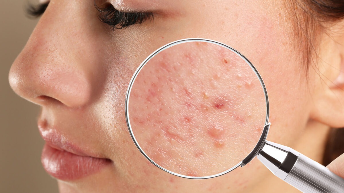 Dermatology Compounding